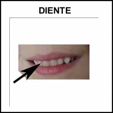 DIENTE - Foto