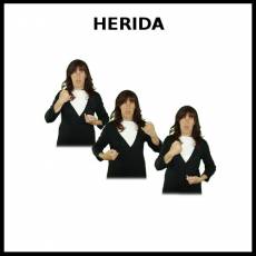 HERIDA - Signo