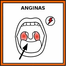 ANGINAS - Pictograma (color)