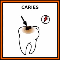 CARIES - Pictograma (color)