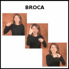 BROCA - Signo