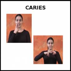 CARIES - Signo