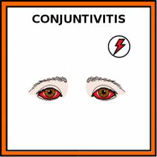 CONJUNTIVITIS - Pictograma (color)