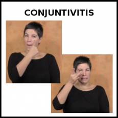 CONJUNTIVITIS - Signo