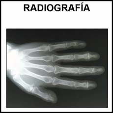 RADIOGRAFÍA - Foto
