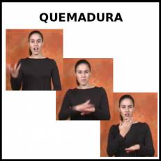 QUEMADURA - Signo