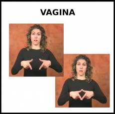 VAGINA - Signo