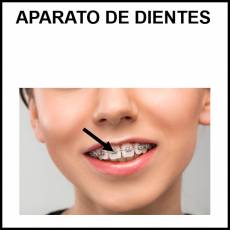 APARATO DE DIENTES - Foto