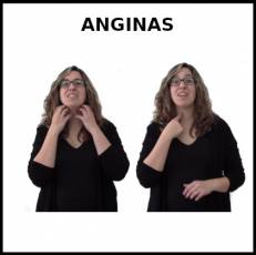 ANGINAS - Signo